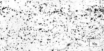 supercritical fluid recrystallization